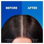 Head & Shoulders Anti-Dandruff Hairfall Shampoo 400Ml - Image 4